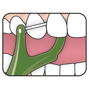 TEPE TARPDANČIŲ SIŪLAS – GOOD MINI FLOSSER