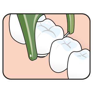 TEPE TARPDANČIŲ SIŪLAS – GOOD MINI FLOSSER